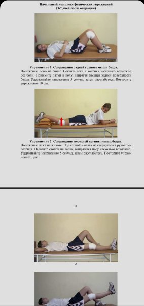 Реабилитация после артроскопии коленного сустава