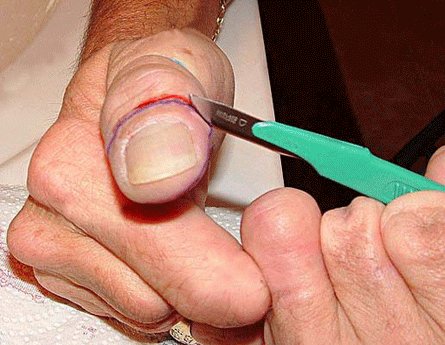 Такого дурака вы еще не видели